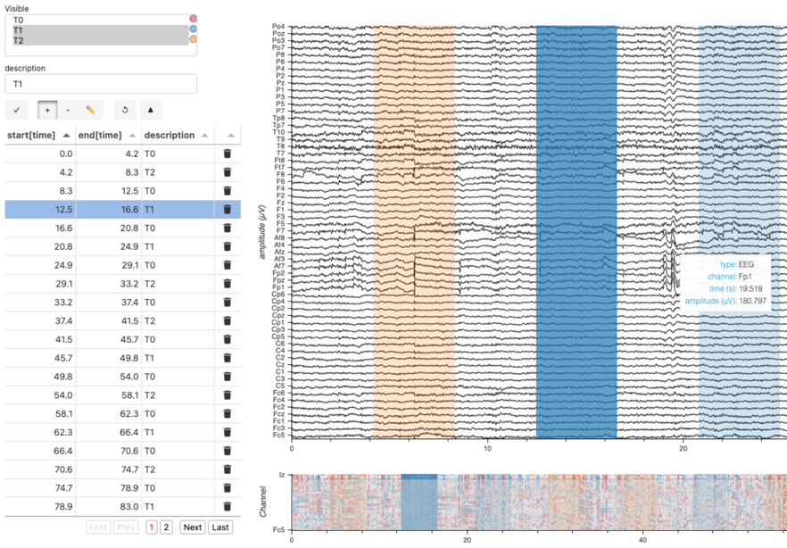 Multichannel Timeseries